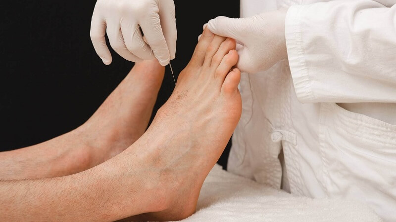 طب سوزنی چقدر در درمان پا درد موثر است؟