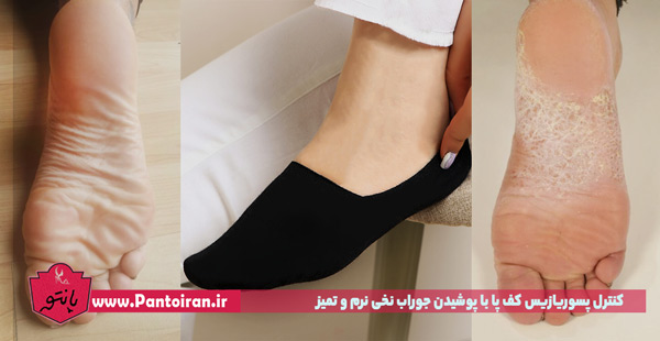 درمان پسوریازیس کف پا با پوشیدن جوراب نخی تمیز نرم و مرطوب نگه داشتن