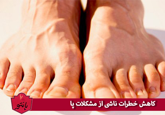 کاهش خطرات ناشی از مشکلات پا با دمپایی طبی مردانه